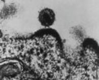 fauci_aidsvirus_26nov03_0.jpg